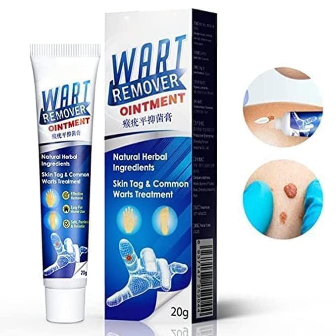 Wart Remover Cream
