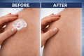Lipoma Removal Cream - IMPORTED