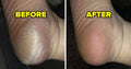 Rechargeable Electric Foot Callus Remover ( Imported)